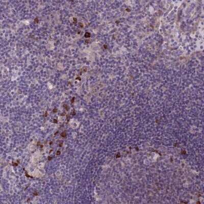 Immunohistochemistry-Paraffin: Lymphotoxin beta/TNFSF3 Antibody [NBP2-14207] - Staining of human lymph node shows strong cytoplasmic positivity in subset of non germinal and germinal center cells.