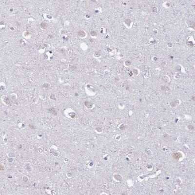 Immunohistochemistry-Paraffin: Lymphotoxin beta/TNFSF3 Antibody [NBP2-14207] - Staining of human cerebral cortex shows very weak positivity in neurons.