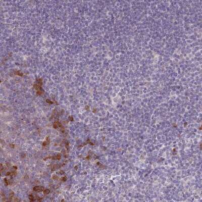 Immunohistochemistry-Paraffin: Lymphotoxin beta/TNFSF3 Antibody [NBP2-14207] - Staining of human tonsil shows moderate positivity in non-germinal center cells.