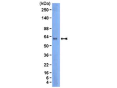 Western Blot: Lyn Antibody (10A6.2) [NBP2-29697] - A431 cell lysate was resolved by electrophoresis, transferred to PVDF membrane and probed with ant-Lyn, clone 10A6.2 (1:1000). Proteins were visualized using a goat anti-mouse secondary antibody conjugated to HRP and a chemiluminescent detection system.  Arrow indicates Lyn (~58 kDa).