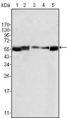 Western Blot: Lyn Antibody (2H8D7) [NB110-60538] - Analysis using LYN mouse mAb agains HL60 (1), L540 (2), SLLP-M2 (3), SEM (4) and Ramos (5) cell lysate.