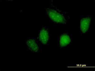 Immunocytochemistry/Immunofluorescence: Lyn Antibody [H00004067-B01P] - Analysis of purified antibody to LYN on HeLa cell. (antibody concentration 10 ug/ml)