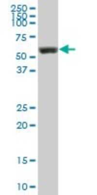 Western Blot: Lyn Antibody [H00004067-B01P] - Analysis of LYN expression in human spleen.