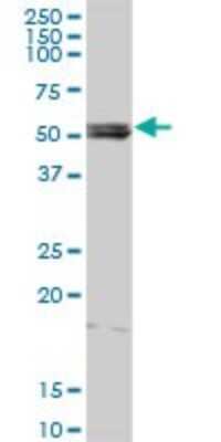 Western Blot: Lyn Antibody [H00004067-D01P] - Analysis of LYN expression in mouse spleen.