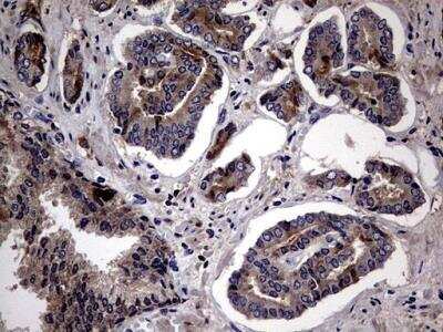 Immunohistochemistry-Paraffin: Lysine Hydroxylase 2/PLOD2 Antibody (6D1) [NBP2-46451] - Analysis of Human prostate tissue.