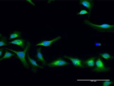 Immunocytochemistry/Immunofluorescence: Lysine Hydroxylase 2/PLOD2 Antibody [H00005352-D01P] - Analysis of antibody to PLOD2 on HeLa cell. Antibody concentration 30 ug/ml.