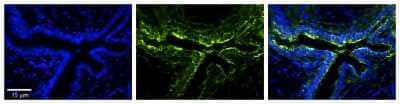 Immunohistochemistry-Paraffin: Lysine Hydroxylase 2/PLOD2 Antibody [NBP1-58004] - Formalin Fixed Paraffin; Embedded Tissue: Human Bronchial Epithelial Tissue; Observed Staining: Cytoplasmic; Primary Antibody Concentration: 1:100