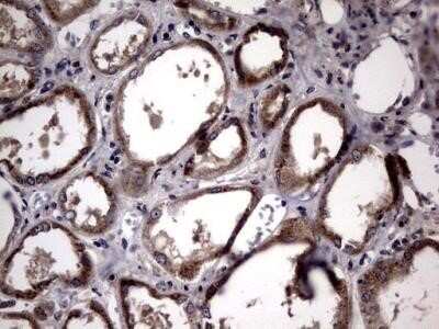 Immunohistochemistry: Lysine Hydroxylase 2/PLOD2 Antibody (OTI6D1) - Azide and BSA Free [NBP2-72556] - Analysis of Human Kidney tissue.