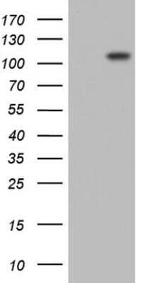 Western Blot: Lysine Hydroxylase 2/PLOD2 Antibody (OTI6D1) - Azide and BSA Free [NBP2-72556] - Analysis of HEK293T cells were transfected with the pCMV6-ENTRY control (Left lane) or pCMV6-ENTRY PLOD2.