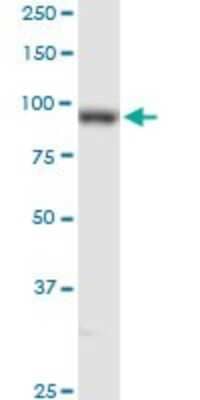 Western Blot: Lysine Hydroxylase 2/PLOD2 Antibody [H00005352-D01P] - Analysis of PLOD2 expression in HeLa.