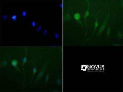Immunocytochemistry/Immunofluorescence: Lysine (K)-specific Demethylase 3A/KDM3A/JMJD1A Antibody [NBP1-49601] -  Antibody was tested at 1:50 in HeLa cells with FITC (green). Nuclei (Blue) were counterstained with DAPI (blue).