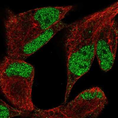 Immunocytochemistry/Immunofluorescence: Lysine (K)-specific Demethylase 3A/KDM3A/JMJD1A Antibody [NBP2-56228] - Staining of human cell line RH-30 shows localization to nucleoplasm.