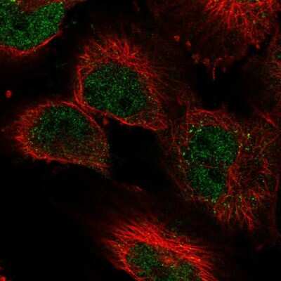 Immunocytochemistry/Immunofluorescence: Lysine (K)-specific Demethylase 3A/KDM3A/JMJD1A Antibody [NBP2-56254] - Staining of human cell line U-251 MG shows localization to nucleoplasm.