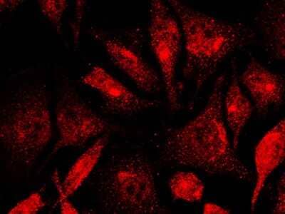 Immunocytochemistry/Immunofluorescence: Lysine (K)-specific Demethylase 3A/KDM3A/JMJD1A Antibody [NBP2-98966] - Immunofluorescence staining of Lysine (K)-specific Demethylase 3A/KDM3A/JMJD1A in HeLa cells. Cells were fixed with 4% PFA, blocked with 10% serum, and incubated with rabbit anti-human Lysine (K)-specific Demethylase 3A/KDM3A/JMJD1A polyclonal antibody (1:5000) at 4C overnight. Then cells were stained with the Alexa Fluor(R)594-conjugated Goat Anti-rabbit IgG secondary antibody (red).Positive staining was localized to cytoplasm and nucleus.