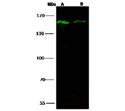 Western Blot: Lysine (K)-specific Demethylase 3A/KDM3A/JMJD1A Antibody [NBP2-98966] - Anti-Lysine (K)-specific Demethylase 3A/KDM3A/JMJD1A rabbit polyclonal antibody at 1:500 dilution. Lane A: Hela Whole Cell Lysate. Lane B: HepG2 Whole Cell Lysate. Lysates/proteins at 30 ug per lane. Secondary Goat Anti- Rabbit IgG H&L (Dylight 800) at 1/10000 dilution. Developed using the Odyssey technique. Performed under reducing conditions. Predicted band size: 147 kDa. Observed band size: 147 kDa