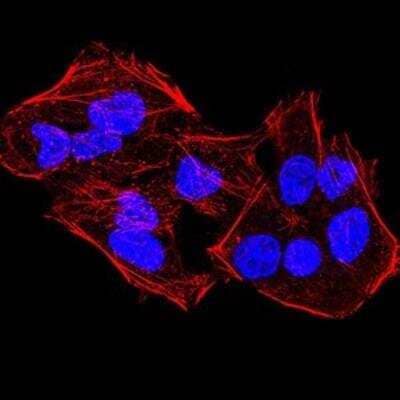 Immunocytochemistry/Immunofluorescence: Lysine (K)-specific Demethylase 4A/KDM4A/JMJD2A Antibody (6E10G4) [NBP2-52499] - Analysis of HeLa cells using KDM4A mouse mAb. Blue: DRAQ5 fluorescent DNA dye. Red: Actin filaments have been labeled with Alexa Fluor- 555 phalloidin.