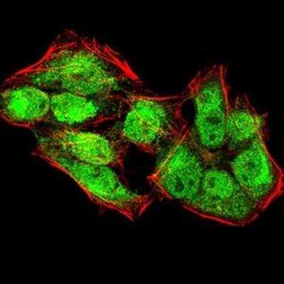 Immunocytochemistry/Immunofluorescence: Lysine (K)-specific Demethylase 4A/KDM4A/JMJD2A Antibody (6E10G4) [NBP2-52499] - Analysis of HeLa cells using KDM4A mouse mAb (green). Blue: DRAQ5 fluorescent DNA dye. Red: Actin filaments have been labeled with Alexa Fluor- 555 phalloidin.