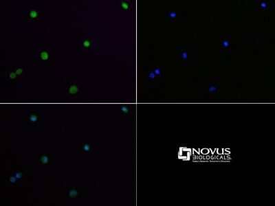 Immunocytochemistry/Immunofluorescence: Lysine (K)-specific Demethylase 4A/KDM4A/JMJD2A Antibody [NBP1-49602] - Antibody was tested at 1:50 in HeLa cells with FITC (green). Nuclei (Blue) were counterstained with Dapi (blue).