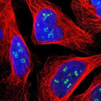 Immunocytochemistry/Immunofluorescence: Lysine (K)-specific Demethylase 4A/KDM4A/JMJD2A Antibody [NBP1-87855] - Staining of human cell line U-2 OS shows positivity in nucleoli.