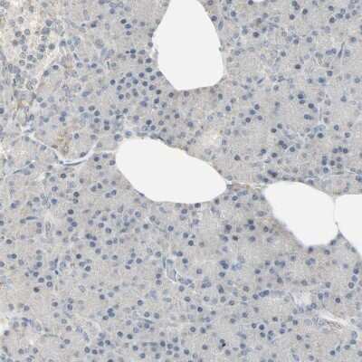 Immunohistochemistry-Paraffin: Lysine (K)-specific Demethylase 4A/KDM4A/JMJD2A Antibody [NBP1-87855] - Staining of human pancreas shows no positivity in exocrine glandular cells as expected.