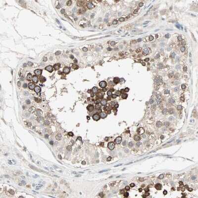 Immunohistochemistry-Paraffin: Lysine (K)-specific Demethylase 4A/KDM4A/JMJD2A Antibody [NBP1-87855] - Staining of human testis shows strong cytoplasmic positivity in cells in seminiferous ducts.