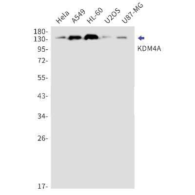 Western Blot: Lysine (K)-specific Demethylase 4A/KDM4A/JMJD2A Antibody (S01-7F2) [NBP3-15055] - Western blot detection of Lysine (K)-specific Demethylase 4A/KDM4A/JMJD2A in Hela, A549, HL-60, U2OS, U87-MG cell lysates using Lysine (K)-specific Demethylase 4A/KDM4A/JMJD2A Rabbit mAb (1:1000 diluted). Observed band size: 150kDa.