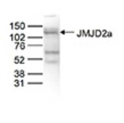 Western Blot: Lysine (K)-specific Demethylase 4A/KDM4A/JMJD2A Antibody [NBP3-18688] - Figure 2. Western blot analysis using the antibody directed against Lysine (K)-specific Demethylase 4A/KDM4A/JMJD2A Nuclear extracts from HeLa cells (40 ug) were analysed by Western blot using the antibody against Lysine (K)-specific Demethylase 4A/KDM4A/JMJD2A diluted 1:500 in TBS-Tween containing 5% skimmed milk. The position of the protein of interest is indicated on the right (expected size 121 kDa); the marker (in kDa) is shown on the left.