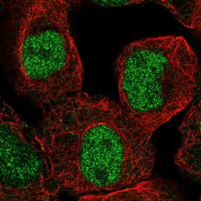 Immunocytochemistry/Immunofluorescence: Lysine (K)-specific Demethylase 4C/KDM4C/JMJD2C Antibody [NBP2-57484] - Staining of human cell line A-431 shows localization to nucleoplasm.