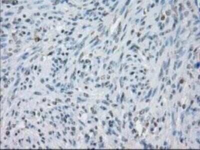 Immunohistochemistry: Lysine (K)-specific Demethylase 4C/KDM4C/JMJD2C Antibody (OTI5B9) - Azide and BSA Free [NBP2-72553] - Staining of paraffin-embedded Ovary tissue using anti-JMJD2C mouse monoclonal antibody.