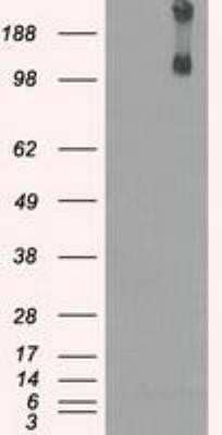 Western Blot: Lysine (K)-specific Demethylase 4C/KDM4C/JMJD2C Antibody (OTI5B9) - Azide and BSA Free [NBP2-72553] - HEK293T cells were transfected with the pCMV6-ENTRY control (Left lane) or pCMV6-ENTRY JMJD2C(Right lane) cDNA for 48 hrs and lysed. Equivalent amounts of cell lysates (5 ug per lane) were separated by SDS-PAGE and immunoblotted with anti-JMJD2C.