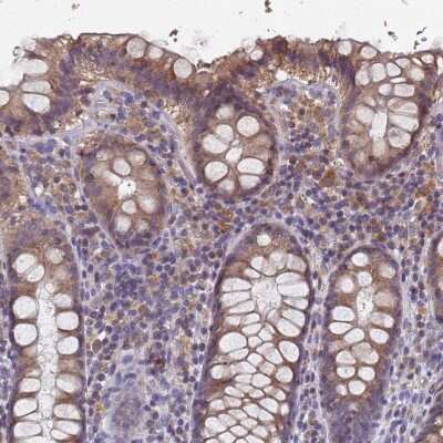 Immunohistochemistry-Paraffin: Lysine-rich coiled-coil 1 Antibody [NBP1-92092] - Staining of human rectum shows moderate cytoplasmic positivity in glandular cells.