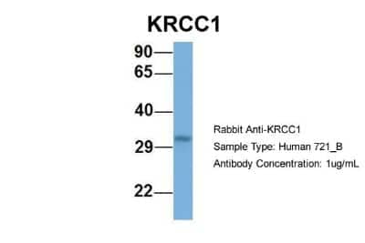 Western Blot: Lysine-rich coiled-coil 1 Antibody [NBP1-79654] - Human 721_B, Antibody Dilution: 1.0 ug/ml KRCC1 is supported by BioGPS gene expression data to be expressed in 721_B.