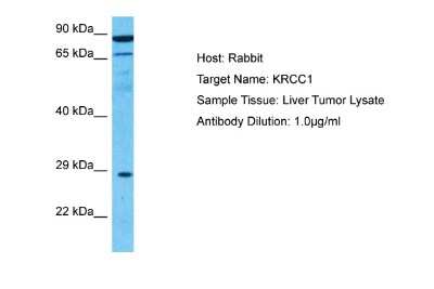 Western Blot: Lysine-rich coiled-coil 1 Antibody [NBP2-87759] - Host: Rabbit. Target Name: KRCC1. Sample Type: Liver Tumor lysates. Antibody Dilution: 1.0ug/ml