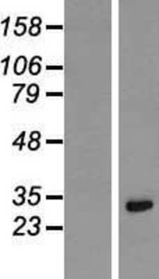 Western Blot: Lysine-rich coiled-coil 1 Overexpression Lysate (Adult Normal) [NBL1-12377] Left-Empty vector transfected control cell lysate (HEK293 cell lysate); Right -Over-expression Lysate for Lysine-rich coiled-coil 1.