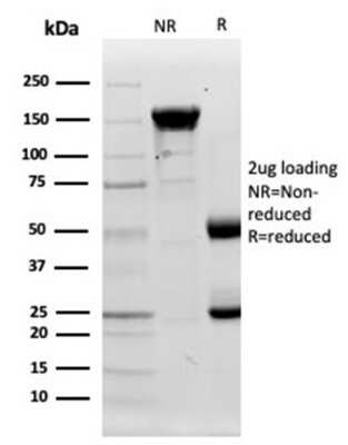 Protein Array: Lysozyme Antibody (LYZ/3944) - Azide and BSA Free [NBP3-14115] - Analysis of Protein Array containing more than 19,000 full-length human proteins using Lysozyme Antibody (LYZ/3944).