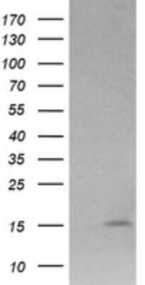 Western Blot: Lysozyme Antibody (OTI1C9) - Azide and BSA Free [NBP2-72557] - Analysis of HEK293T cells were transfected with the pCMV6-ENTRY control (Left lane) or pCMV6-ENTRY Lysozyme.