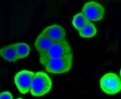 Immunocytochemistry/Immunofluorescence: Lysozyme Antibody (ST50-02) [NBP2-67507] - Staining Lysozyme in CRC cells (green). The nuclear counter stain is DAPI (blue). Cells were fixed in paraformaldehyde, permeabilised with 0.25% Triton X100/PBS.