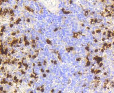 Immunohistochemistry-Paraffin: Lysozyme Antibody (ST50-02) [NBP2-67507] - Analysis of paraffin-embedded human spleen tissue using anti-Lysozyme antibody. Counter stained with hematoxylin. The nuclear counter stain is DAPI (blue).