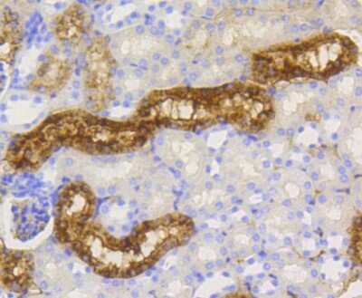 Immunohistochemistry-Paraffin: Lysozyme Antibody (ST50-02) [NBP2-67507] - Analysis of paraffin-embedded mouse kidney tissue using anti-Lysozyme antibody. Counter stained with hematoxylin.