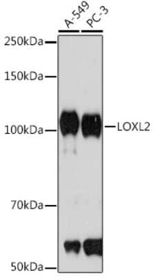 Western Blot: Lysyl Oxidase Homolog 2/LOXL2 Antibody (9F0W6) [NBP3-16466] - Western blot analysis of extracts of various cell lines, using Lysyl Oxidase Homolog 2/LOXL2 Rabbit mAb (NBP3-16466) at 1:1000 dilution. Secondary antibody: HRP Goat Anti-Rabbit IgG (H+L) at 1:10000 dilution. Lysates/proteins: 25ug per lane. Blocking buffer: 3% nonfat dry milk in TBST. Detection: ECL Basic Kit. Exposure time: 90s.