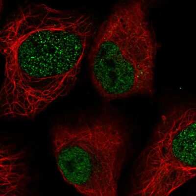 Immunocytochemistry/Immunofluorescence: Lysyl Oxidase Homolog 2/LOXL2 Antibody [NBP2-55314] - Staining of human cell line U-2 OS shows localization to nucleoplasm.