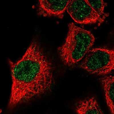 Immunocytochemistry/Immunofluorescence: Lysyl Oxidase Homolog 2/LOXL2 Antibody [NBP2-56739] - Staining of human cell line A549 shows localization to nucleoplasm.