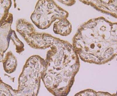 Immunohistochemistry: Lysyl Oxidase Homolog 2/LOXL2 Antibody [NBP2-76946] - Immunohistochemical analysis of paraffin-embedded human placenta tissue using anti-LOXL2 antibody. Counter stained with hematoxylin. The section was pretreated using heat mediated antigen retrieval with sodium citrate buffer (pH6) for 20 mins.