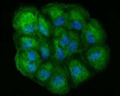 Immunocytochemistry/Immunofluorescence: Lysyl Oxidase Homolog 2/LOXL2 Antibody (JU32-53) [NBP2-75559] - Staining LOXL2 in A431 cells (green). The nuclear counter stain is DAPI (blue). Cells were fixed in paraformaldehyde, permeabilised with 0.25% Triton X100/PBS.