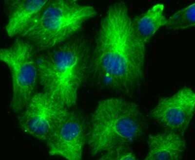 Immunocytochemistry/Immunofluorescence: Lysyl Oxidase Homolog 2/LOXL2 Antibody (JU32-53) [NBP2-75559] - Staining LOXL2 in A549 cells (green). The nuclear counter stain is DAPI (blue). Cells were fixed in paraformaldehyde, permeabilised with 0.25% Triton X100/PBS.