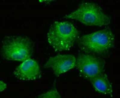 Immunocytochemistry/Immunofluorescence: Lysyl Oxidase Homolog 2/LOXL2 Antibody (JU32-53) [NBP2-75559] - Staining LOXL2 in HUVEC cells (green). The nuclear counter stain is DAPI (blue). Cells were fixed in paraformaldehyde, permeabilised with 0.25% Triton X100/PBS.