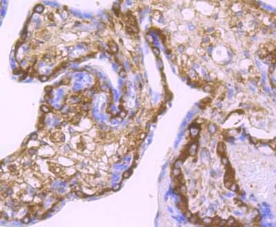 Immunohistochemistry-Paraffin: Lysyl Oxidase Homolog 2/LOXL2 Antibody (JU32-53) [NBP2-75559] - Analysis of paraffin-embedded human placenta tissue using anti-LOXL2 antibody. Counter stained with hematoxylin.