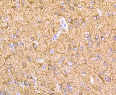 Immunohistochemistry-Paraffin: Lysyl Oxidase Homolog 2/LOXL2 Antibody (JU32-53) [NBP2-75559] - Analysis of paraffin-embedded rat brain tissue using anti-LOXL2 antibody. Counter stained with hematoxylin.