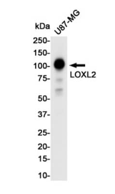 Western Blot: Lysyl Oxidase Homolog 2/LOXL2 Antibody (S09-7J5) [NBP3-19679] - Western blot detection of Lysyl Oxidase Homolog 2/LOXL2 in U87-MG cell lysates using NBP3-19679 (1:1000 diluted). Predicted band size: 87KDa. Observed band size: 105KDa.