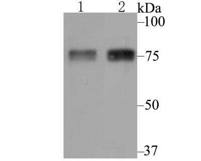 Western Blot: Lysyl Oxidase Homolog 2/LOXL2 Antibody [NBP2-76946] - Western blot analysis of LOXL2 on A549 and A431 cell lysate using anti-LOXL2 antibody at 1/500 dilution.